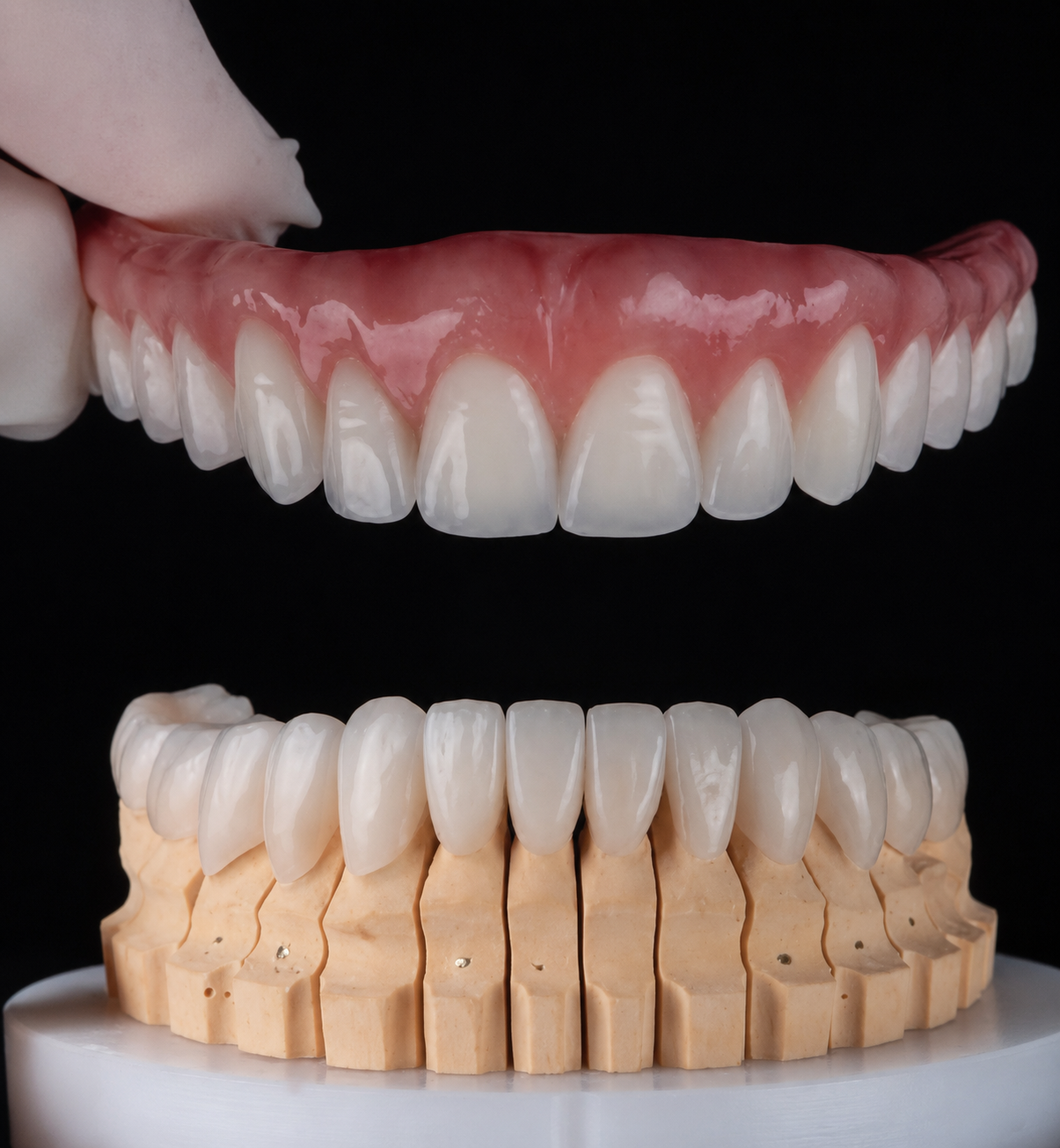 Prótese sobre implantes e coroas cerâmicas individualizadas